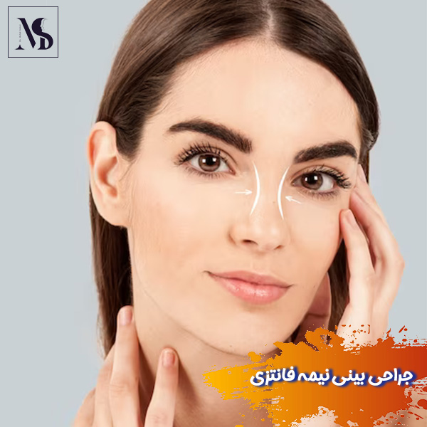 جراحی بینی نیمه فانتزی - دکتر مهدی صابری
