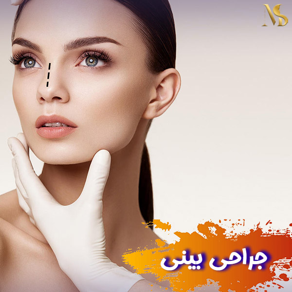 جراحی بینی - دکتر مهدی صابری