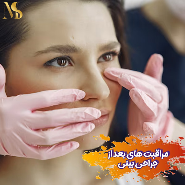 مراقبت های بعد از جراحی بینی