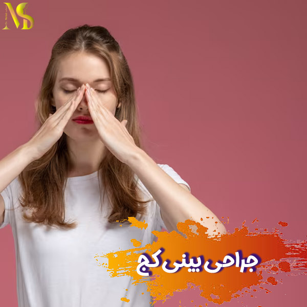 جراحی بینی کج