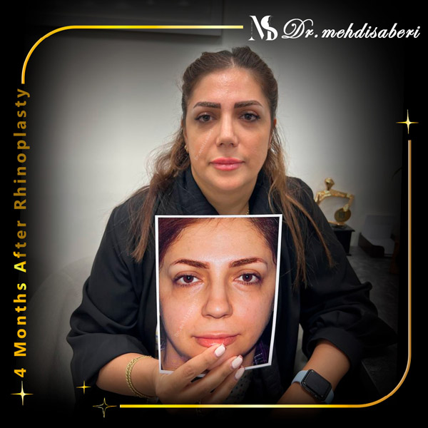 عمل بینی در تهران