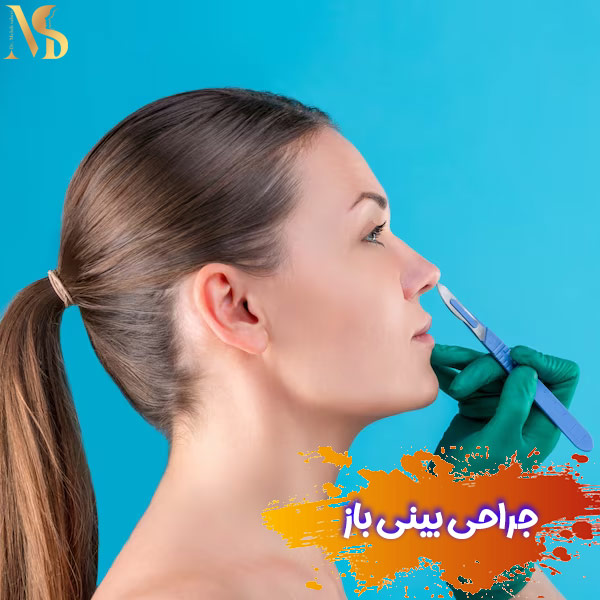 جراحی بینی باز