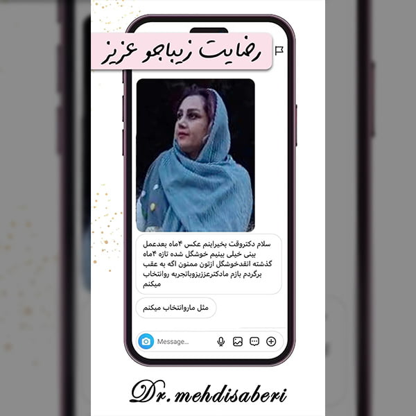 رضایت زیباجو از بهترین جراح بینی