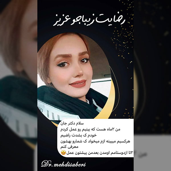 رضایت زیباجو از بهترین جراح بینی