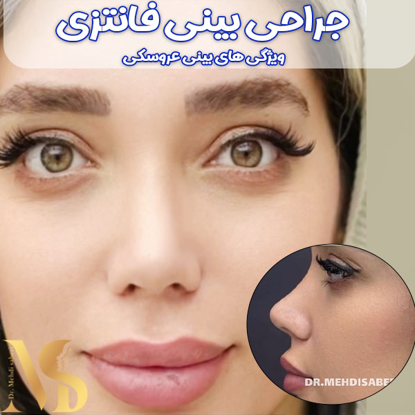 جراحی بینی فانتزی