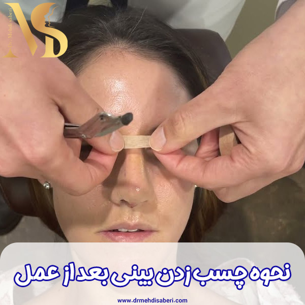 چسب زدن بینی بعد از جراحی