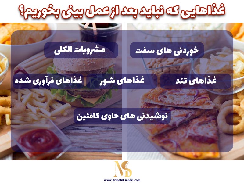 غذاهایی که نباید بعد از عمل بینی بخوریم