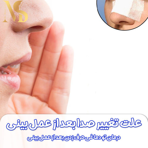 علت تغییر صدا بعد از عمل بینی