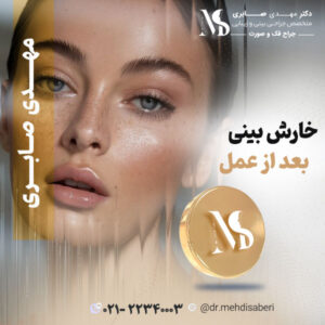 خارش بینی بعد از عمل