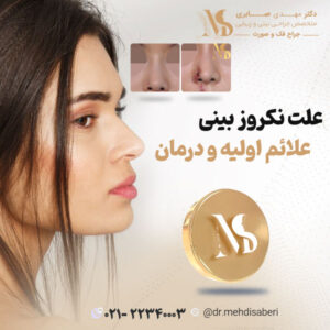 عکس نکروز بینی