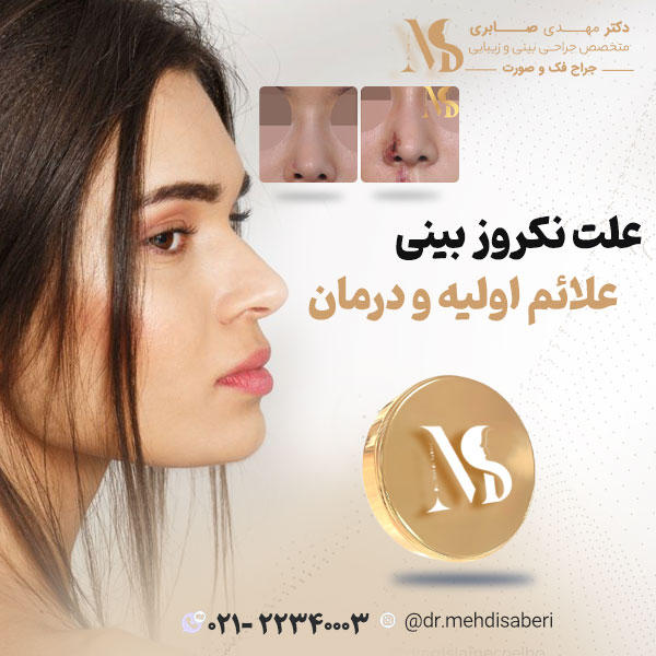عکس نکروز بینی