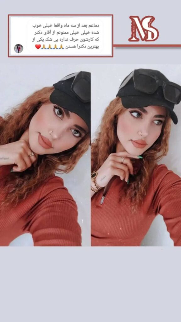 بهترین جراح بینی از نظر کاربران