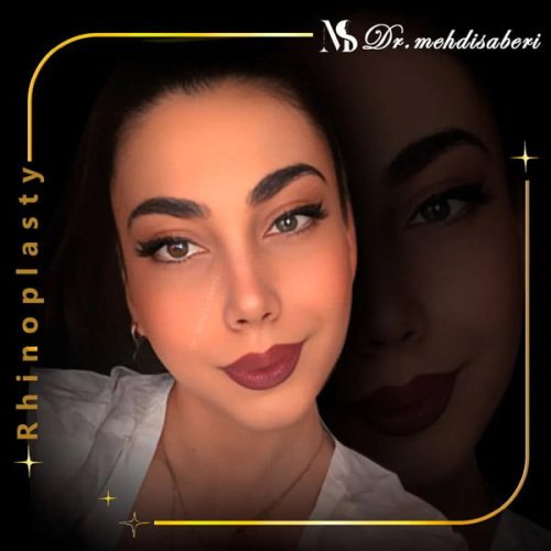 بهترین-جراح-بینی-2 بهترین جراح بینی تهران